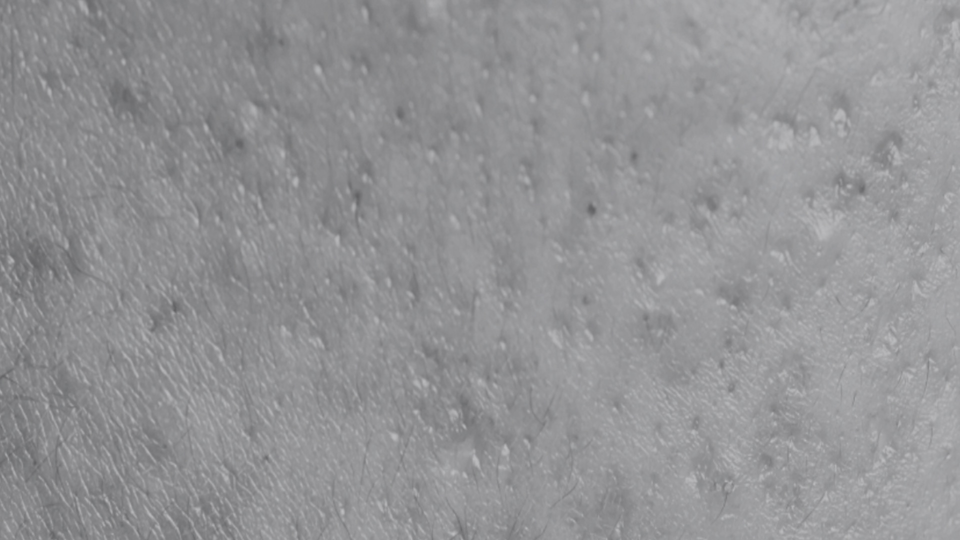 The image shows a close-up view of a person s skin with visible pores, against a blurred background that appears to be a different texture or surface.