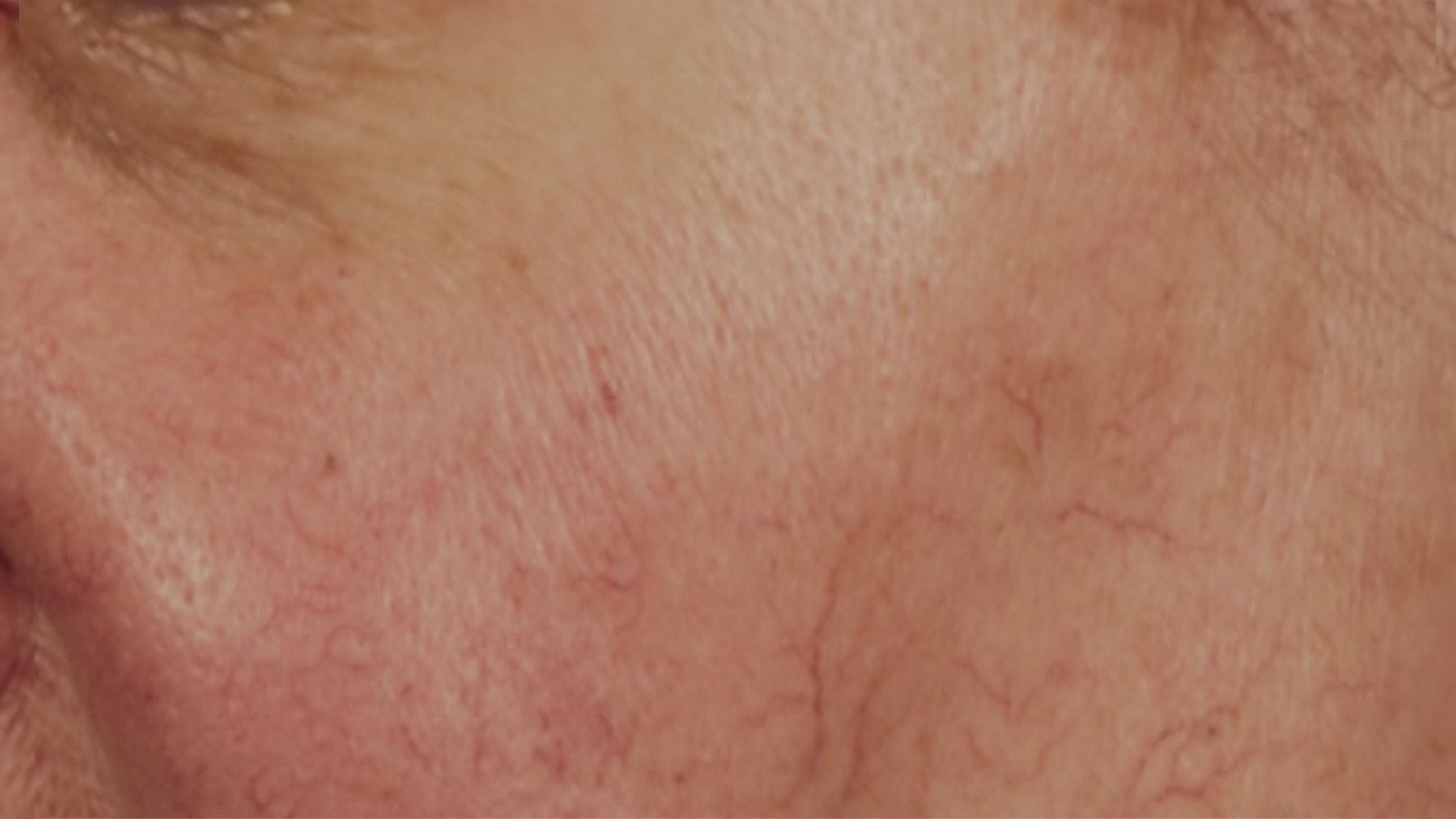 An up-close photograph of a person s face showing signs of aging, such as wrinkles and fine lines around the eyes and mouth area.