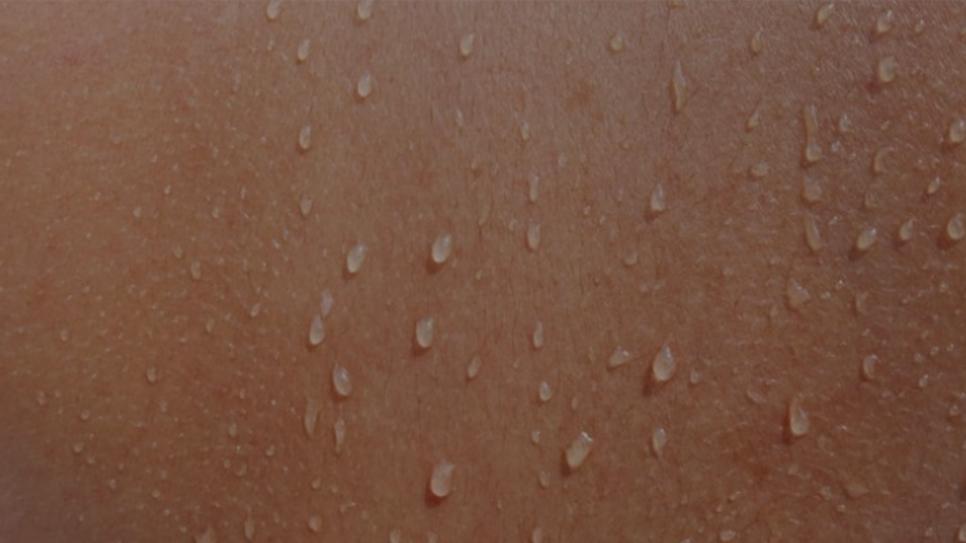 The image shows a close-up view of a person s back with droplets of water on their skin, suggesting they have been sweating or are damp.