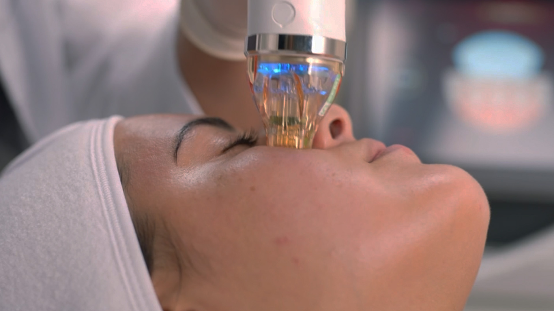 The image shows a person with their eyes closed, receiving an eye treatment, with a device close to their face, possibly at a medical facility.
