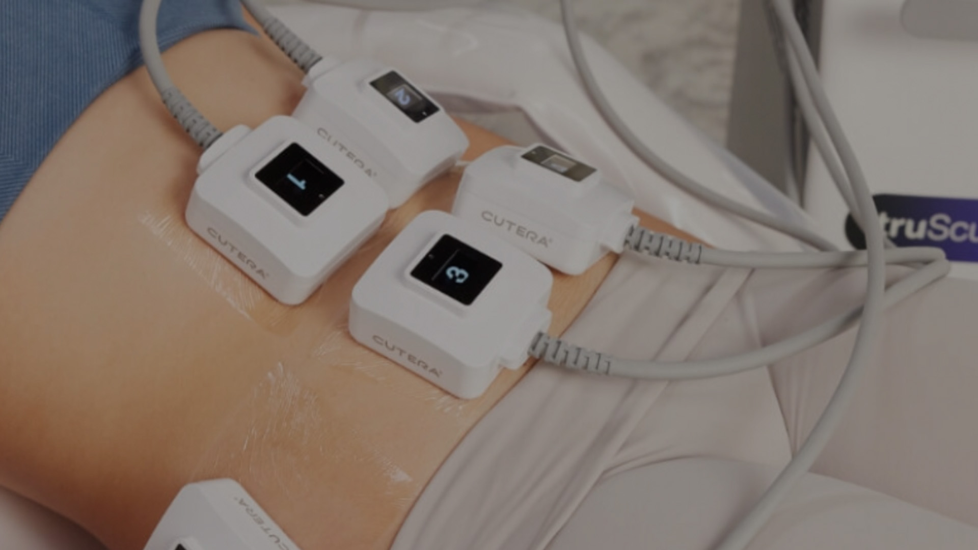 An ultrasound device attached to a person s leg with wires, indicating medical monitoring or treatment.
