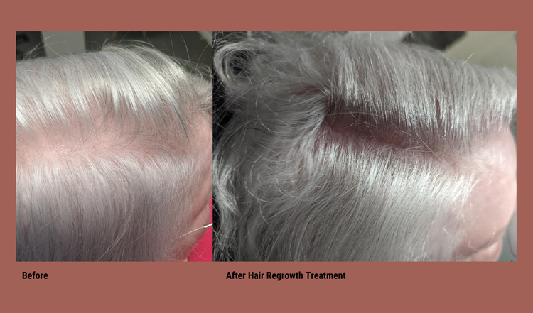 The image shows a before-and-after comparison of a person s hair, with the left side showing graying hair and the right side showing the same hair after treatment, likely indicating a hair coloring process.