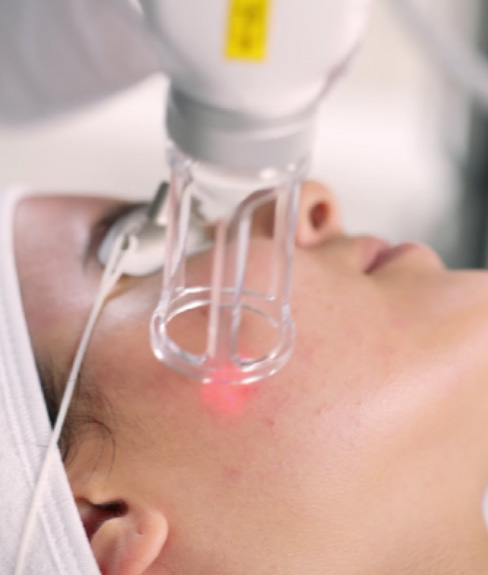 The image shows a close-up view of a person s face with a medical device attached to their forehead, possibly for diagnostic or treatment purposes, with an overlaid filter effect that adds a humorous touch by making the person appear to have two faces.