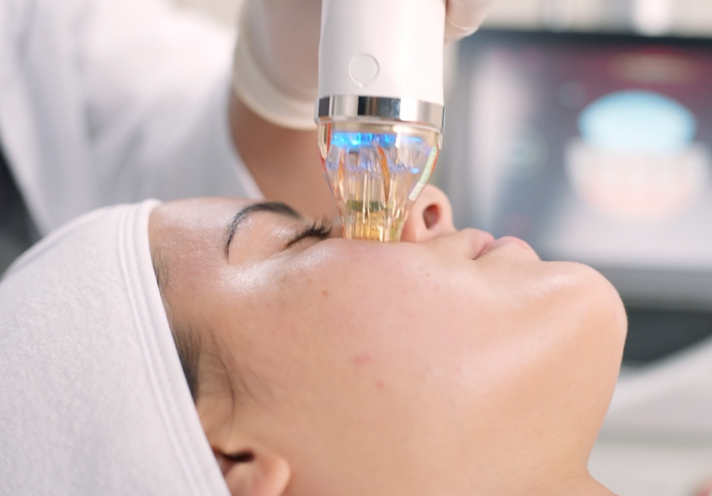 The image shows a person receiving a cosmetic treatment, likely involving a device with a blue light emitting from it, which appears to be focused on their face.