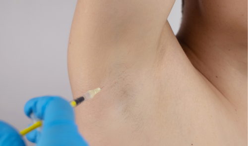 A person receiving a tattoo with a needle in their arm, depicted in a close-up shot.