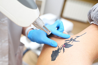 Central Park Laser Aesthetics | Smile Transformation Treatments, Botox and Botox For Migraines