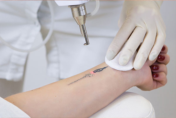 A tattoo machine is being used on someone s arm.