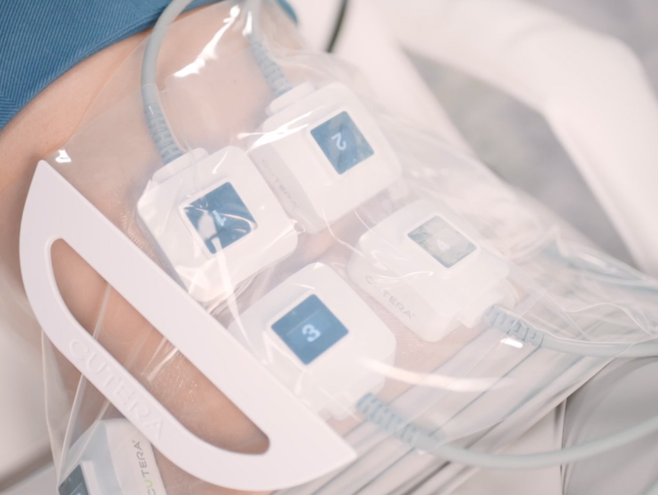 The image shows a clear plastic bag containing medical devices, with the focus on a heart rate monitor and an ECG patch, indicating medical equipment typically used for monitoring patient health during medical procedures or hospital stays.