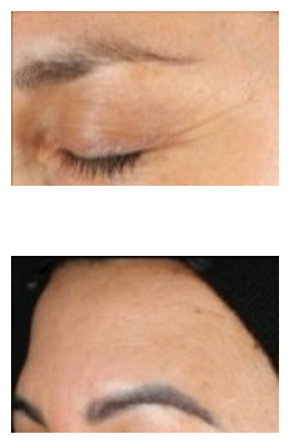The image displays a collage of two photographs showcasing an individual s facial features, with particular focus on their eyebrows, eyelashes, and skin texture.