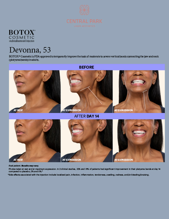 Central Park Laser Aesthetics | Chemical Peel Treatment, Dermal Fillers and Tattoo Removal