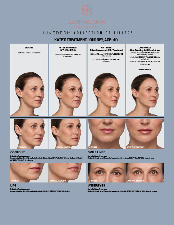 Central Park Laser Aesthetics | Dermal Fillers, Botox For Migraines and Masseter Botox For Teeth Grinding