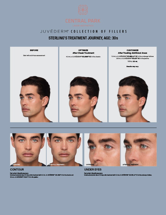 Central Park Laser Aesthetics | Masseter Botox For Teeth Grinding, Body Contouring and Acne Scar Treatment