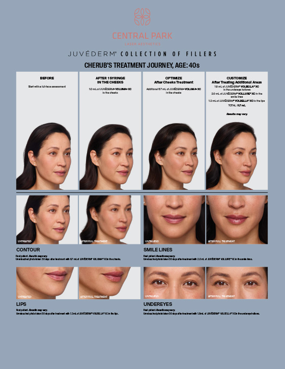 Central Park Laser Aesthetics | KeraHair Regrowth, Co2 Laser Resurfacing and Melasma Treatment