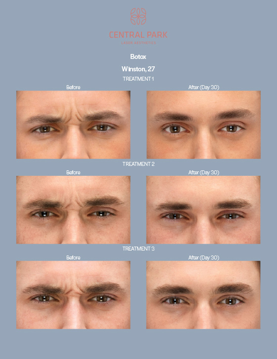 Central Park Laser Aesthetics | Tattoo Removal, Glass Facial and Botox