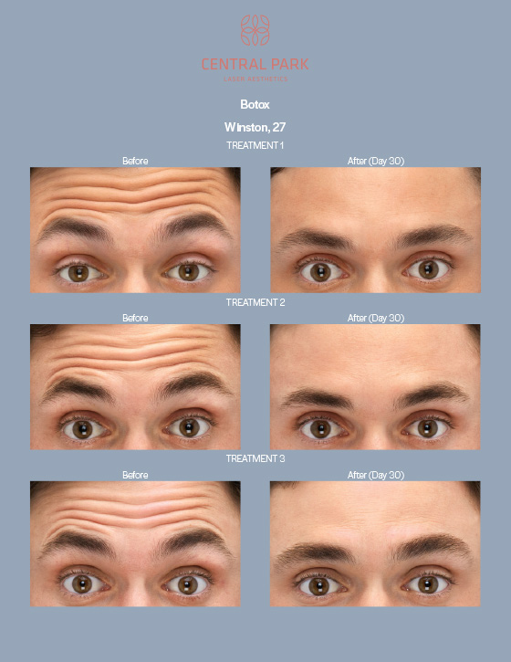 Central Park Laser Aesthetics | Dark Spots Treatment, Tattoo Removal and KeraDuo Hair Regrowth