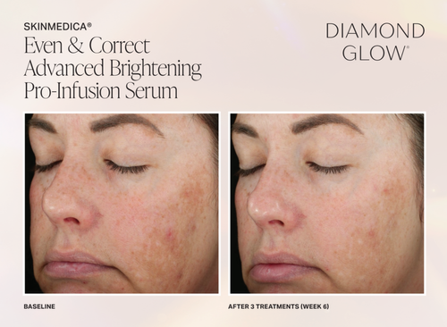 The image features a close-up of a person s face with an advertisement for Diamond Glow Advanced Brightening Pro-Infusion Serum, emphasizing skin improvement through cosmetic treatments.