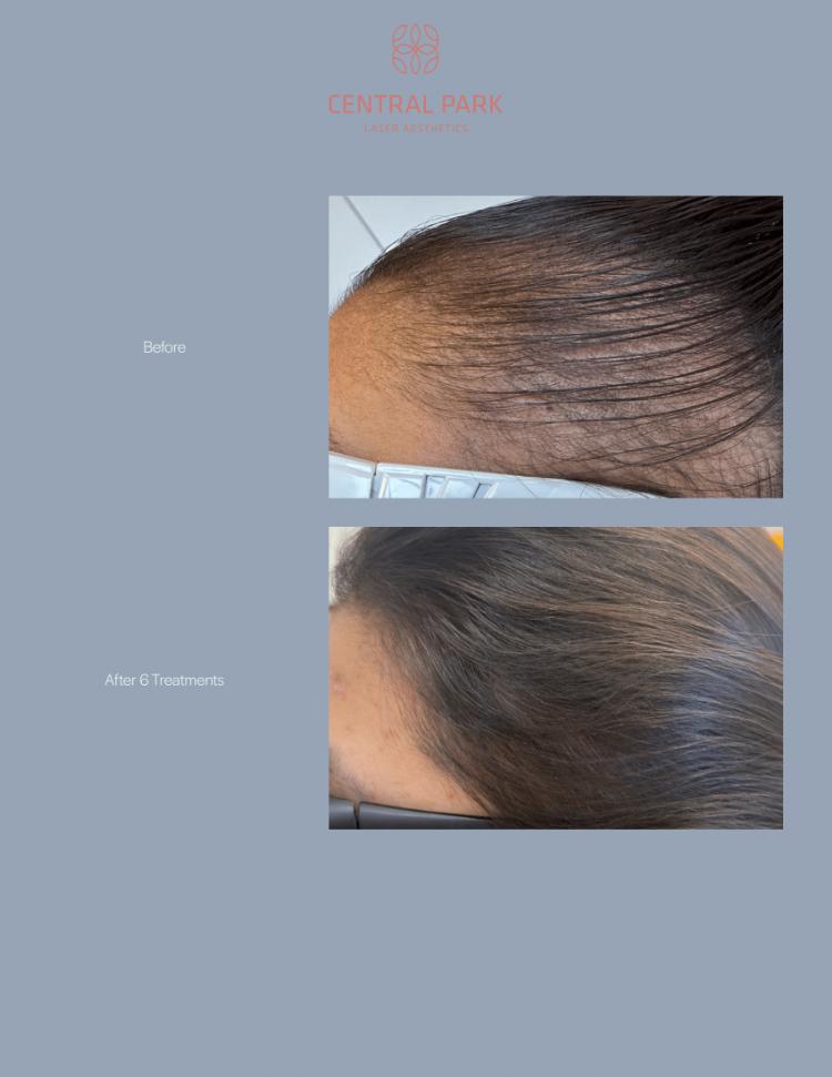 Central Park Laser Aesthetics | Tattoo Removal, Glass Facial and Botox